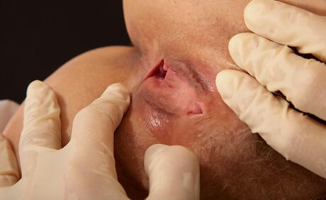 Deluxe aged Caroline 2 exposes her butt 